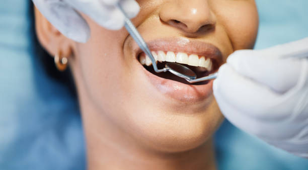 Best Emergency Tooth Extraction in Munford, TN